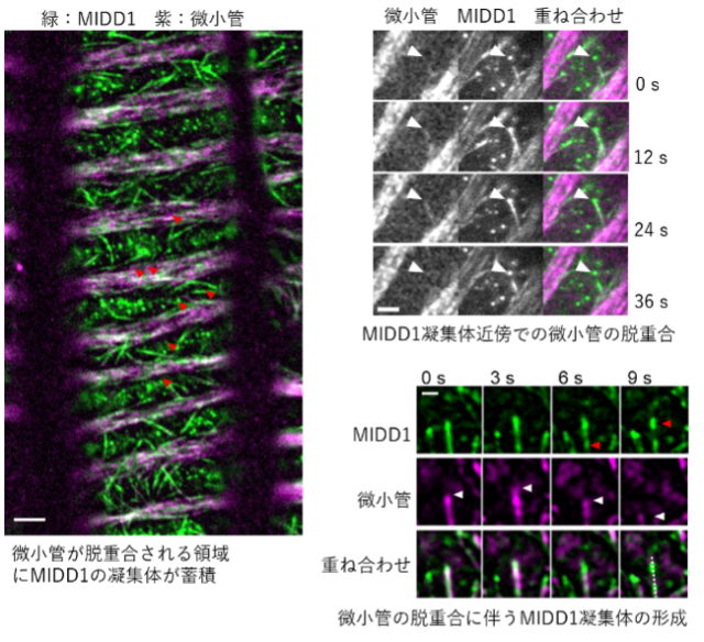 図２　分化中の管状要素におけるMIDD1の挙動。スケールバーは5 µm(左)、２µm(右上・右下)。画像はシロイヌナズナの胚軸の表皮の細胞を人為的に管状要素に分化させ、その過程で観察したもの。