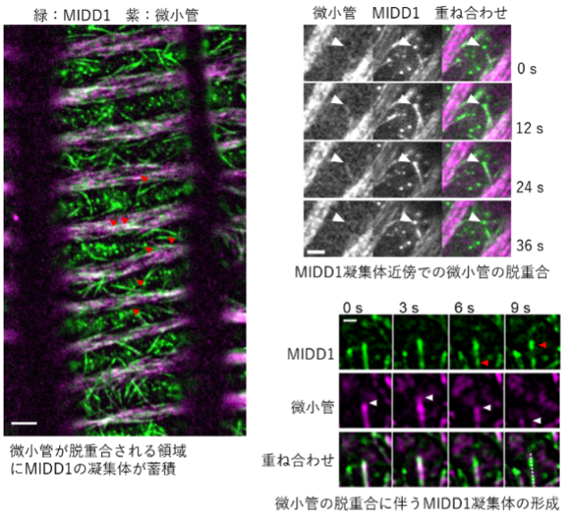 図2 分化中の管状要素におけるMIDD1の挙動。スケールバーは5 µm(左)、2µm(右上・右下)。画像はシロイヌナズナの胚軸の表皮の細胞を人為的に管状要素に分化させ、その過程で観察したもの。
