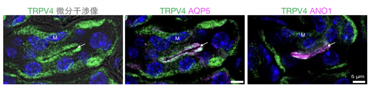 図1. マウス足底の汗腺分泌細胞における蛋白質発現




TRPV4、アノクタミン1 (ANO1)、水チャネルのアクアポリン5 (AQP5)が、分泌細胞の汗が分泌される管腔側（矢印）に共発現していることが分かります。青は核の染色。Mは筋上皮細胞を示す。